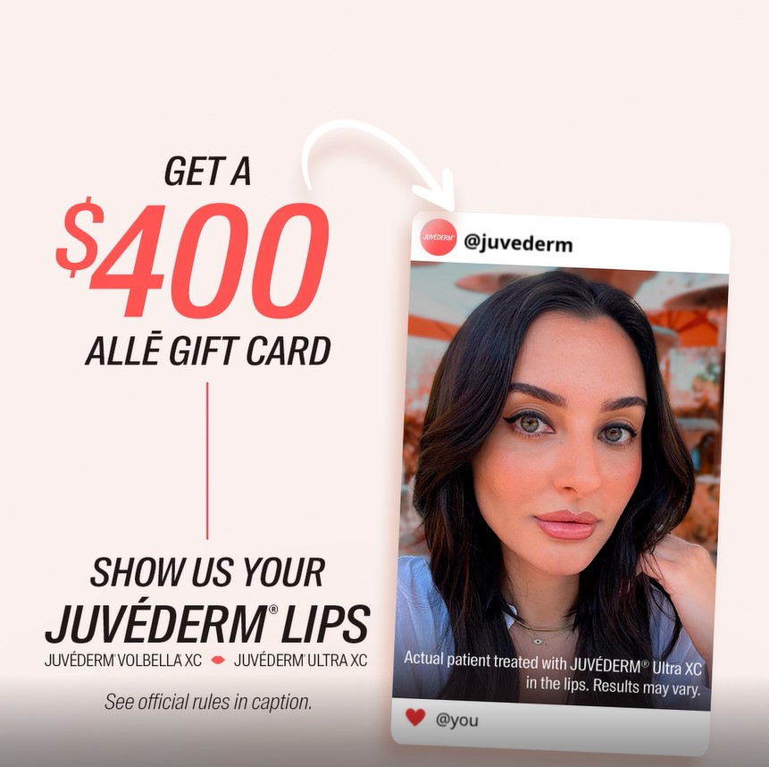 Juvederm Lips Get $400 Gift Card