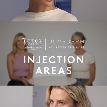 BOTOX® Cosmetic & JUVÉDERM® Collection of Fillers Injection Areas 101 